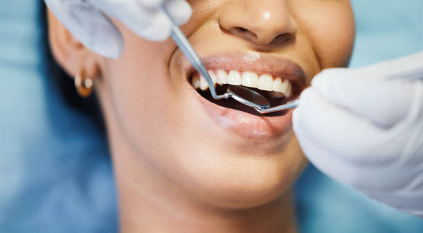 Professional Dental Services in South Monrovia Island, CA